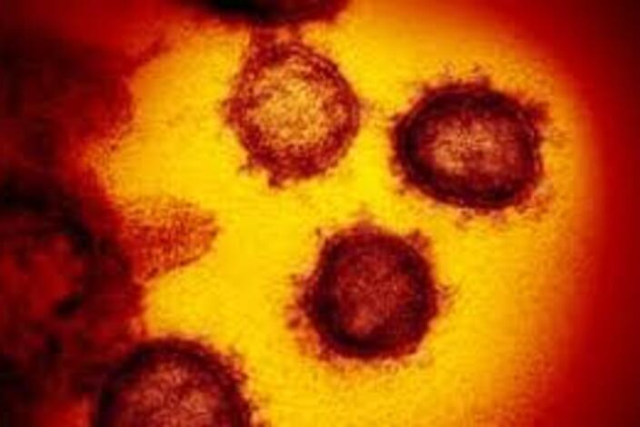 Covid-19%20virus